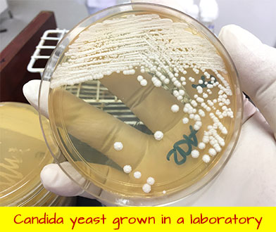 candida-grown-lab
