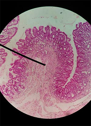 villi-microscope2
