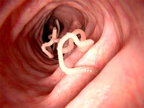 gut-parasite-worms