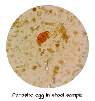 parasite-egg