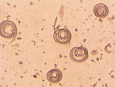 stool-sample-worms