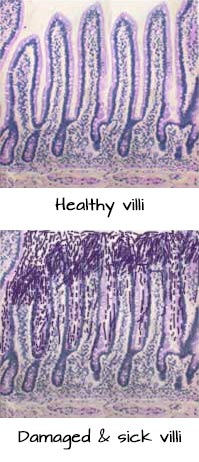 villi-microscope